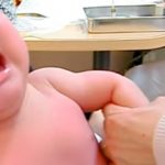 乳児湿疹ができたら病院は何科に行くべき？