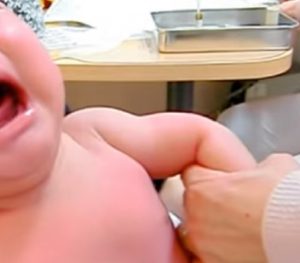 乳児湿疹ができたら病院は何科に行くべき？