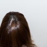 授乳中に髪の毛が抜ける原因は何？いつからいつまで続くの？